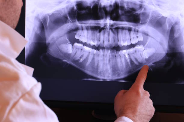 Best Emergency Treatment for Toothache in Toccoa, GA