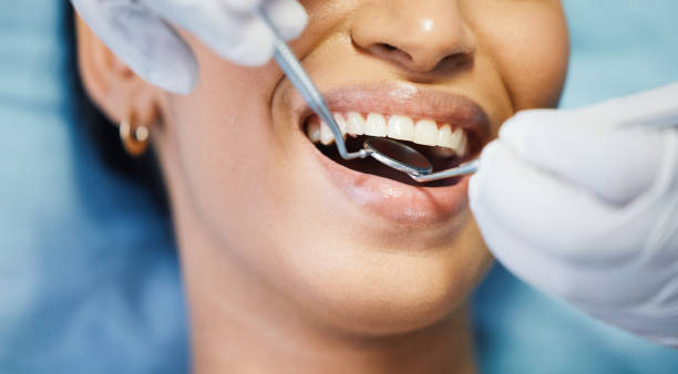 Best Emergency Tooth Extraction in Toccoa, GA
